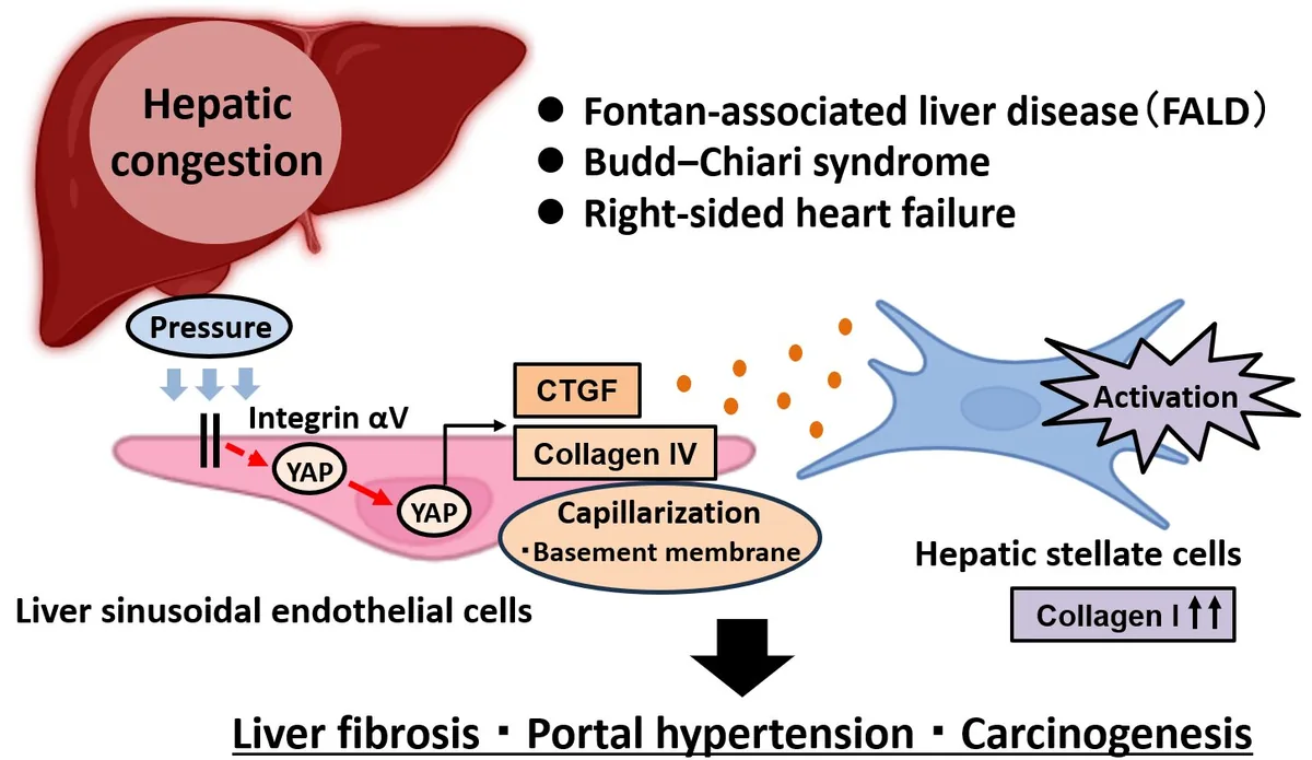 Liver Congestion’s Perilous Path: New Pathway to Fibrosis, Cancer