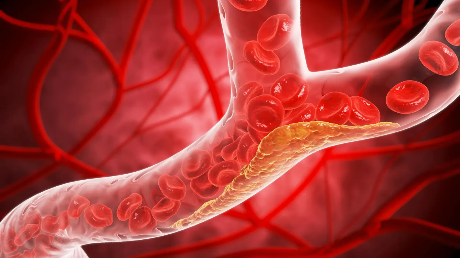 Type 2 Diabetes: Progressive Red Blood Cell Damage to Vessels